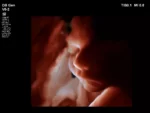 Philips EPIQ 7 Ultrasound System - Image 7