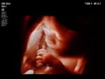 Philips EPIQ 7 Ultrasound System - Image 8