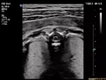 Philips EPIQ 7 Ultrasound System - Image 9