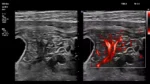 Philips EPIQ 7 Ultrasound System - Image 3