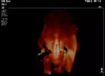 Philips EPIQ 7 Ultrasound System - Image 4
