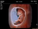 Philips EPIQ 7 Ultrasound System - Image 10