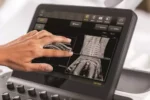 Philips EPIQ 7 Ultrasound System - Image 5