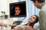 Philips EPIQ 7 Ultrasound System - Image 6