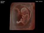Philips EPIQ 7 Ultrasound System - Image 2